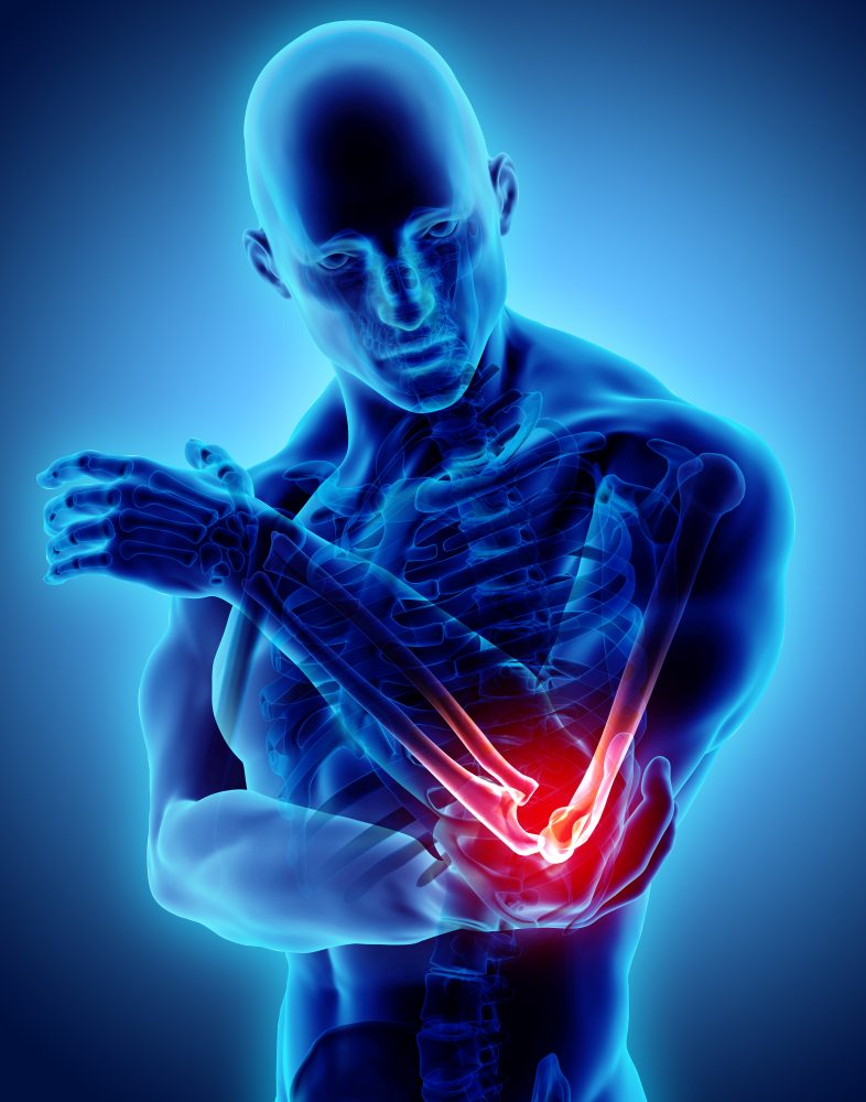 elbow surgery